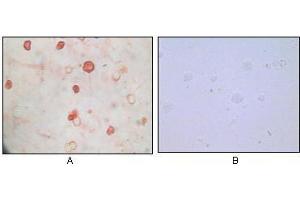 Immunocytochemistry analysis of TPA induced BCBL-1 cells (A) and uninduced BCBL-1 cells (B) using KSHV K8α mouse mAb with AEC staining. (KSHVK8a 抗体)