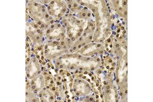 Immunohistochemistry of paraffin-embedded mouse kidney using HIRIP3 antibody (ABIN5974221) at dilution of 1/100 (40x lens). (HIRIP3 抗体)