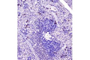IHC analysis of RASAL1 using anti-RASAL1 antibody (ABIN6719367).