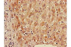 Immunohistochemistry of paraffin-embedded human liver tissue using ABIN7143677 at dilution of 1:100