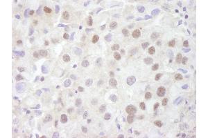 Immunohistochemistry (IHC) image for anti-Prohibitin 2 (PHB2) (AA 1-50) antibody (ABIN7448768)