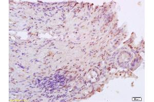 Formalin-fixed and paraffin embedded rat colitis labeled with Anti XRCC4 Polyclonal Antibody, Unconjugated (ABIN1386856) at 1:200 followed by conjugation to the secondary antibody and DAB staining (XRCC4 抗体  (AA 151-260))