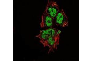 Immunofluorescence analysis of NTERA-2 cells using SOX2 mouse mAb (green). (SOX2 抗体)