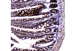Immunohistochemistry (IHC) image for anti-Succinate Dehydrogenase Complex, Subunit B, Iron Sulfur (Ip) (SDHB) (AA 29-280) antibody (ABIN5693211)