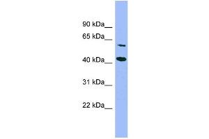 WB Suggested Anti-GFOD1  Antibody Titration: 0. (GFOD1 抗体  (Middle Region))