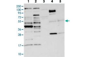 Western blot analysis of Lane 1: RT-4, Lane 2: U-251 MG, Lane 3: Human Plasma, Lane 4: Liver, Lane 5: Tonsil with CCDC34 polyclonal antibody  at 1:250-1:500 dilution. (CCDC34 抗体)