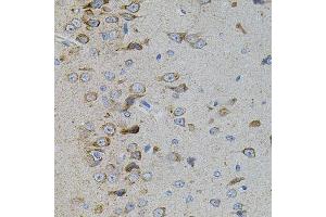 Immunohistochemistry of paraffin-embedded rat brain using MAPK11 antibody. (MAPK11 抗体)