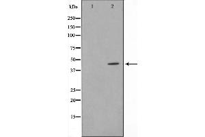 Western blot analysis on Jurkat cell lysate using AL2S7 Antibody,The lane on the left is treated with the antigen-specific peptide. (Cyclin-Dependent Kinase 15 (ALS2CR7) (Internal Region) 抗体)