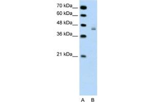 Western Blotting (WB) image for anti-DEAH (Asp-Glu-Ala-His) Box Polypeptide 30 (DHX30) antibody (ABIN2461364) (DHX30 抗体)