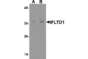 Western blot analysis of IFLTD1 in rat liver tissue lysate with IFLTD1 antibody at (A) 1 and (B) 2 µg/mL. (PAS1C1 抗体  (Middle Region))