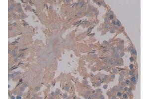 Detection of AMH in Rat Testis Tissue using Polyclonal Antibody to Anti-Mullerian Hormone (AMH) (AMH 抗体  (AA 447-553))