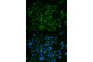 Immunofluorescence analysis of HeLa cells using BAMBI antibody (ABIN5973916).