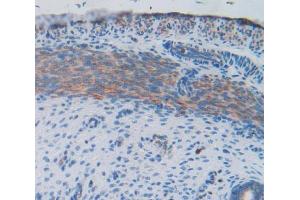 Used in DAB staining on fromalin fixed paraffin- embedded uterus tissue (FIL1d 抗体  (AA 1-156))