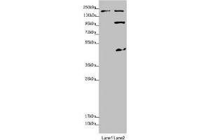 Western blot All lanes: MYO5B antibody at 1. (MYO5B 抗体  (AA 1440-1690))