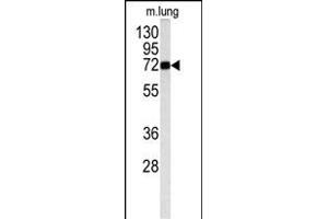 Western blot analysis of OB antibody (Center) (ABIN391715 and ABIN2841607) in mouse lung tissue lysates (35 μg/lane). (Monoamine Oxidase B 抗体  (AA 303-334))