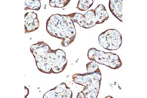 Immunohistochemistry (IHC) image for anti-serine threonine Kinase 39 (STK39) antibody (ABIN1682890)
