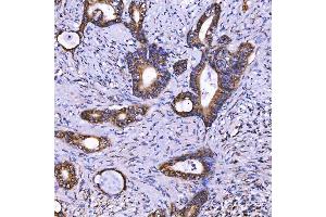IHC analysis of TOM1L1 using anti-TOM1L1 antibody (ABIN7602631). (TOM1L1 抗体  (AA 9-448))