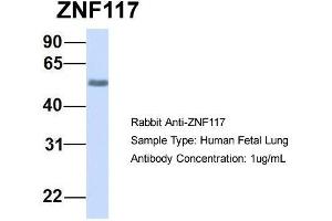 Host:  Rabbit  Target Name:  ZNF117  Sample Type:  Human Fetal Lung  Antibody Dilution:  1. (Zinc Finger Protein 117 抗体  (N-Term))