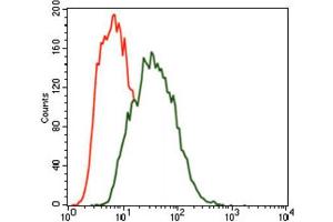 Immunohistochemical analysis of paraffin-embedded bladder cancer tissues using MARK3 antibody with DAB staining. (MARK3 抗体  (AA 435-658))