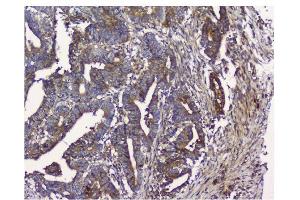 IHC analysis of NMI using anti-NMI antibody (ABIN3043451).
