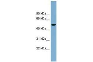 Image no. 1 for anti-Solute Carrier Family 2 (Facilitated Glucose Transporter) Member 8 (SLC2A8) (AA 323-372) antibody (ABIN6743220) (SLC2A8 抗体  (AA 323-372))