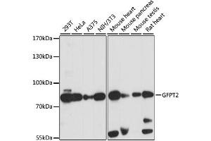Western blot analysis of extracts of various cell lines, using GFPT2 antibody.