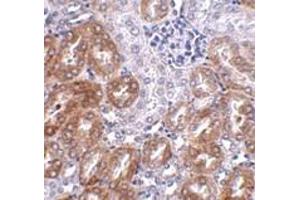 Immunohistochemistry (IHC) image for anti-Ankyrin Repeat Domain 54 (ANKRD54) (C-Term) antibody (ABIN1030482) (ANKRD54 抗体  (C-Term))