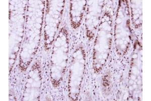 Immunohistochemistry (IHC) image for anti-Nucleoporin 50kDa (NUP50) (C-Term) antibody (ABIN2856374)