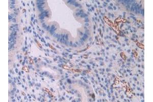 Detection of OSM in Mouse Uterus Tissue using Polyclonal Antibody to Oncostatin M (OSM)