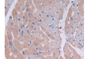 Detection of MYLK2 in Mouse Heart Tissue using Polyclonal Antibody to Myosin Light Chain Kinase 2 (MYLK2) (MYLK2 抗体  (AA 330-548))