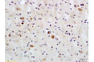 Formalin-fixed and paraffin embedded rat brain tissue labeled with Rabbit Anti-PACAP-38 Polyclonal Antibody  , Unconjugated at 1:200 followed by conjugation to the secondary antibody and DAB staining. (PACAP-38 抗体  (AA 31-38))