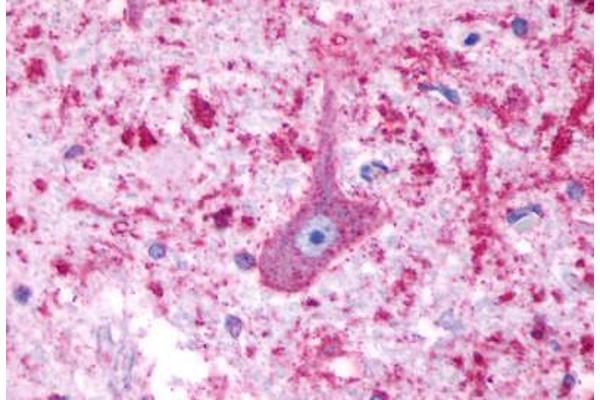 Serotonin Receptor 4 抗体  (Cytoplasmic Domain)