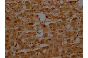 IHC image of ABIN7127348 diluted at 1:100 and staining in paraffin-embedded human liver tissue performed on a Leica BondTM system. (Recombinant ATF5 抗体)