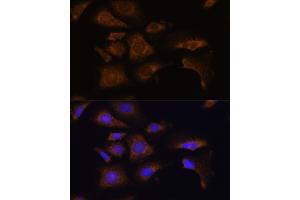 Immunofluorescence analysis of U-2 OS cells using RPS25 antibody (ABIN7270020) at dilution of 1:100. (RPS25 抗体  (C-Term))