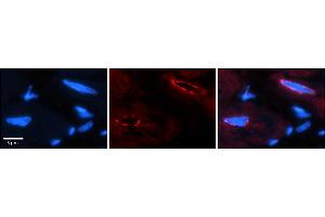 Rabbit Anti-TCF20 Antibody    Formalin Fixed Paraffin Embedded Tissue: Human Adult heart  Observed Staining: Nuclear (nuclear membrane) Primary Antibody Concentration: 1:100 Secondary Antibody: Donkey anti-Rabbit-Cy2/3 Secondary Antibody Concentration: 1:200 Magnification: 20X Exposure Time: 0.