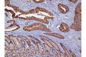 Immunohistochemistry (IHC) image for anti-Keratin 19 (KRT19) (C-Term) antibody (ABIN870579) (Cytokeratin 19 抗体  (C-Term))