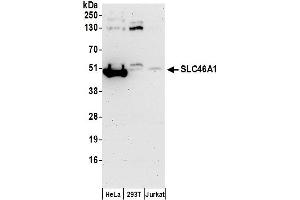 anti-Solute Carrier Family 46 (Folate Transporter), Member 1 (SLC46A1) (AA 225-275) antibody