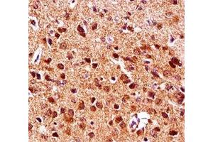 Gsk3b antibody immunohistochemistry analysis in formalin fixed and paraffin embedded mouse brain tissue. (GSK3 beta 抗体  (AA 30-59))