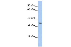 WB Suggested Anti-ZNF584 Antibody Titration:  0. (ZNF584 抗体  (Middle Region))