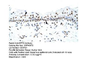 Rabbit Anti-SFPQ Antibody  Paraffin Embedded Tissue: Human Skin Cellular Data: Squamous epithelial cells Antibody Concentration: 4.