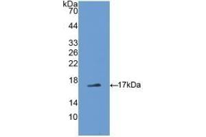 Detection of Recombinant ADP, Rat using Polyclonal Antibody to Adiponectin (ADPN) (ADIPOQ 抗体  (AA 111-244))