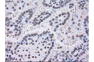 Image no. 1 for anti-Polo-Like Kinase 1 (PLK1) antibody (ABIN1500281) (PLK1 抗体)