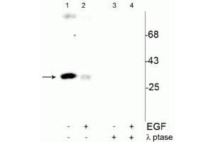 Western blot of human T47D cells showing specific immunolabeling of the ~34 kDa cdc2 phosphorylated at Tyr15 (Control, Lane 1). (CDK1 抗体  (pTyr15))