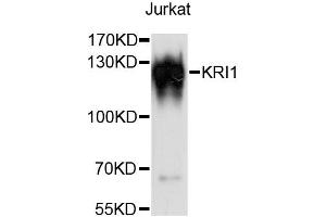 Western blot analysis of extracts of Jurkat cells, using KRI1 antibody (ABIN6294054) at 1:3000 dilution. (KRI1 抗体)