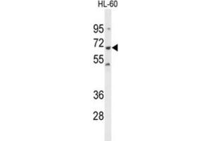 Western Blotting (WB) image for anti-Protein-tyrosine Phosphatase 1C (PTPN6) antibody (ABIN3001647) (SHP1 抗体)