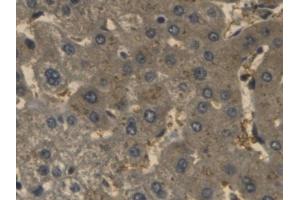 Immunohistochemistry (IHC) image for anti-Haptoglobin (HP) (AA 168-319) antibody (ABIN7426061)