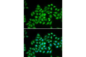 Immunofluorescence analysis of HeLa cells using ATP2A2 antibody. (ATP2A2 抗体)