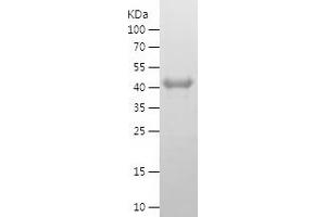 MEIS3 Protein (AA 1-358) (His tag)
