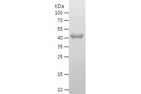 MEIS3 Protein (AA 1-358) (His tag)