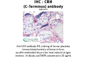 Image no. 1 for anti-Corticotropin Releasing Hormone (CRH) (C-Term) antibody (ABIN1733308) (CRH 抗体  (C-Term))